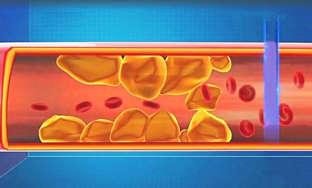 比糖和鹽更“可怕”的調(diào)味劑，我們可能每天都在吃！怪不得三高、肥胖等找上門