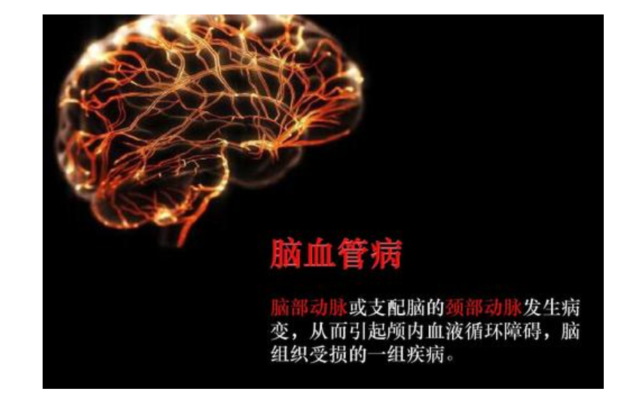 維生素D與神經(jīng)系統(tǒng)疾病相關(guān)性研究進展